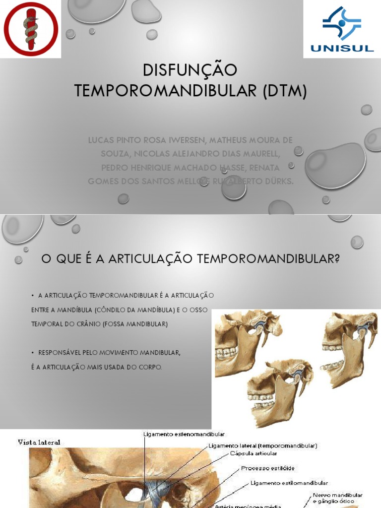 Resumo de disfunção temporomandibular: diagnóstico, tratamento e mais!