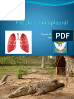 Fístula broncopleural