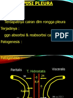Defenisi: Terdapatnya Cairan DLM Rongga Pleura Terjadinya: GGN Absorbsi & Reabsorbsi Cairan Pleura Patogenesis