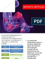 Artritis Infecciosas 123