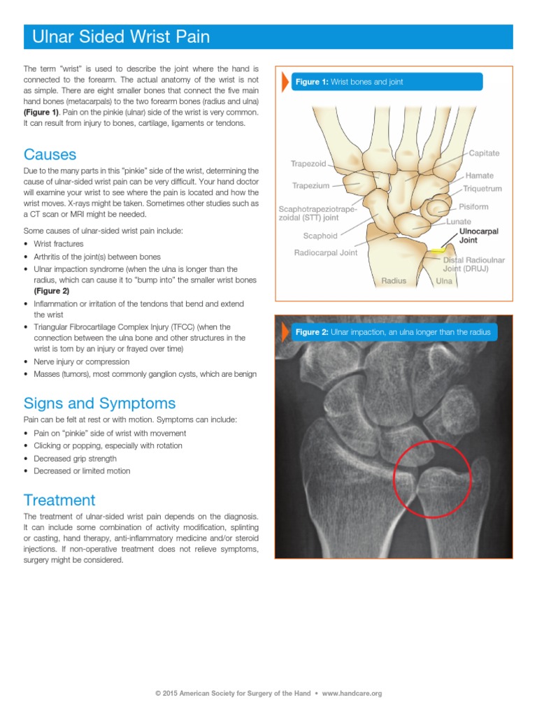 ulnar-sided-wrist-pain-pdf