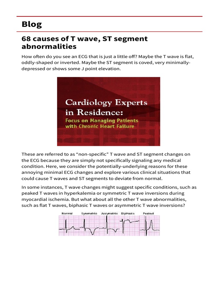 ECG T-Wave & ST Segment Guide | PDF | Electrocardiography | Rtt