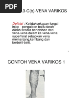 5 Vena Varikos