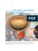 12 Sinais de Câncer de Próstata em Estágio Avançado