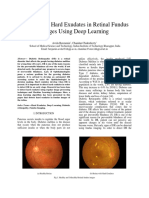 Detection of Hard Exudates in Retinal Fundus Deep Nureal Networks