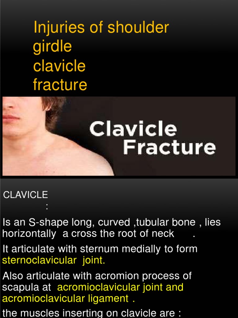 Injuries of Shoulder Girdle Clavicle Fracture Scapula Fracture PDF