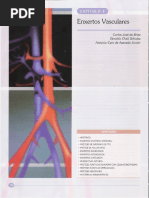 08 - Enxertos Vasculares