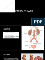 URETEROLITHIASIS