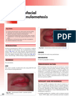 Orofacial Granulomatosis: Fig. 46.1 Fig. 46.2