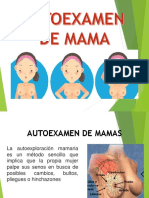 Autoexamen de mamas: Cómo realizarlo y cuándo consultar a un médico