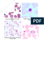 Gambar Laporan Plasmodium