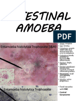 PARA LAB - 2 Intestinal Amoeba111