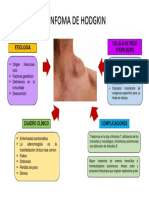 Mapa Linfoma de Hodgkin