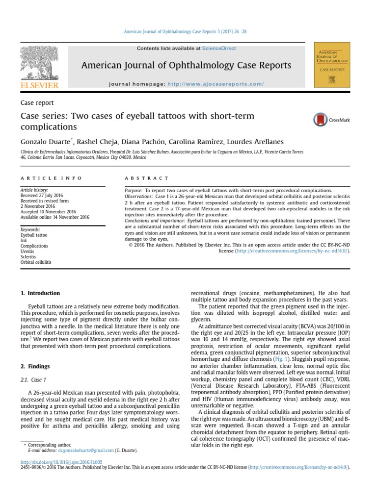 Journal Ophtalmology | PDF | Human Eye | Visual Acuity