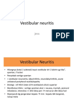 Cara mengenali gejala vestibular neuritis