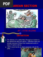 LSCS: Definition, Types, and Indications | PDF | Caesarean Section ...
