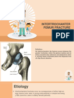 Intertrochanter Femur Fracture: M.Akhyar Baharuddin 20194010011
