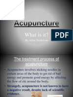 What Is Acupuncture