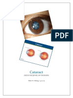 Cataract: (Eye Is The Jewel of The Body)