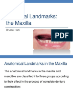 Landmarks of Maxilla