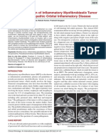 A Rare Association of Inflammatory Myofibroblastic Tumor of Maxilla and Idi