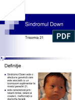 Sindromul Down Trisomia 21