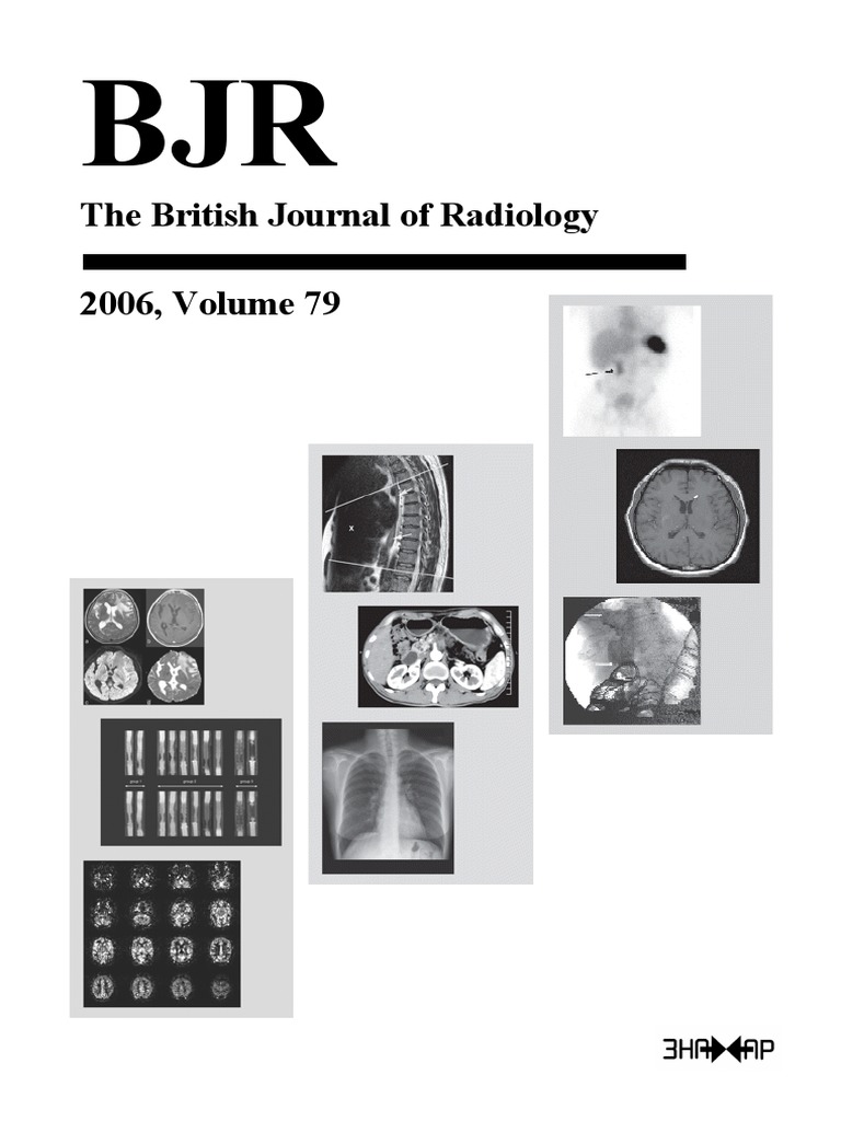 The British Journal of Radiology 2006 PDF | PDF | Ct Scan | Radiology