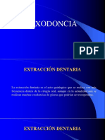 EXODONCIA