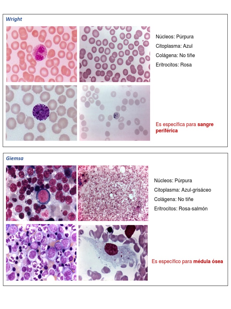 Descripción y comparación de las características de tinción de diversas ...