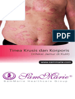 tinea