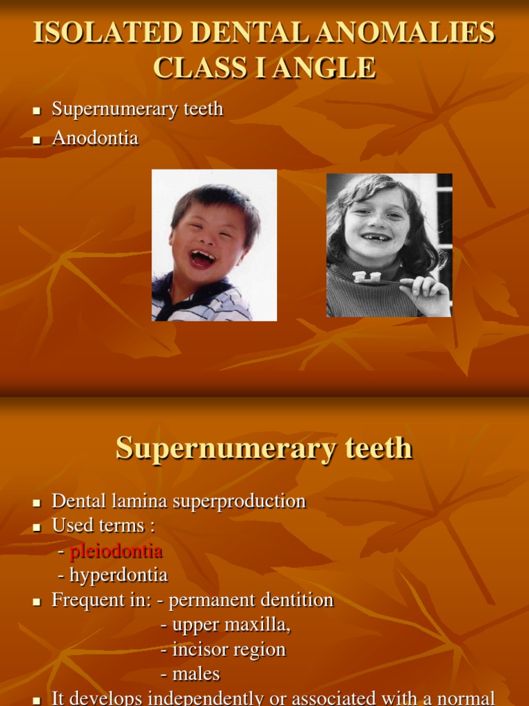 Isolated Dental Anomalies Class I Angle Supernumerary Teeth Anodontia