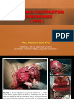 Managing Postpartum Hemorrhage (PPH) : Wisnu Prabowo DR Spog (KFM)