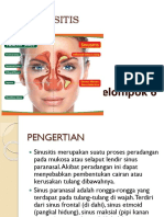 Sinusitis