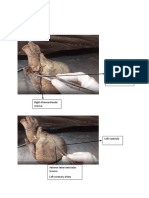 Parts of The Heart: Right Auricle Landmark: Behind Is Superior and Inferior Vena Cava