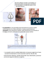Anomalias de Los Genitales Masculinos