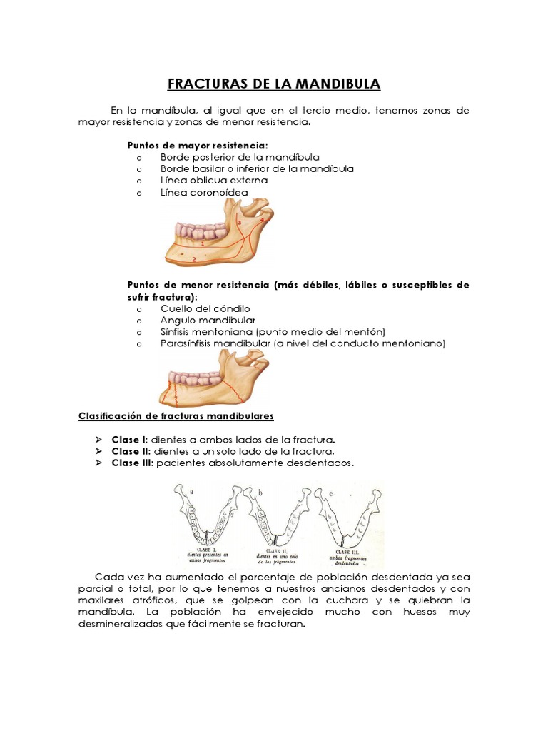 Clase 1 Fractura Mandibular | PDF | Medicina CLINICA | Especialidades ...