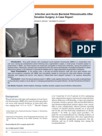 7.management of Wound Infection and Acute Bacterial Rhinosinusitis After Sinus Elevation Surgery