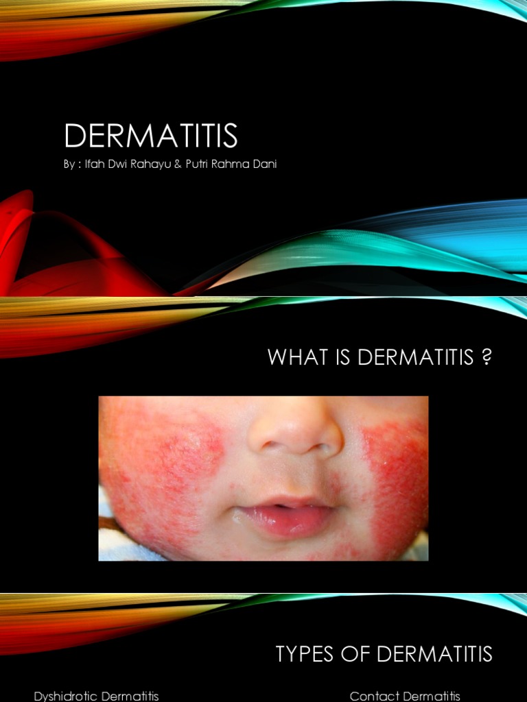 Understanding Dermatitis: Type…