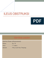 Ileus