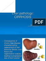 Liver Pathology: Cirrhosis: Ivana Marić