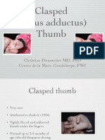 3-1-Clasped Thumb