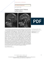 Pituitary Hyperplasia From Primary Hypothyroidism: Images in Clinical Medicine