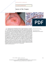 Syphilitic Chancre of The Tongue: Images in Clinical Medicine