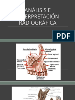 2 y 3 . - Análisis e Interpretación Radiográfica