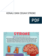 Kenali Dan Cegah Stroke