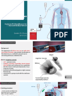 Thrombectomy Using Suction Filtration and Veno-Venous Bypass: Single Center Experience With A Novel Device