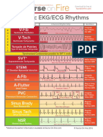 Basic_EKG_ECG_Rhythms_Cheatsheet.pdf