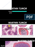 Wartin Tumor Presentation