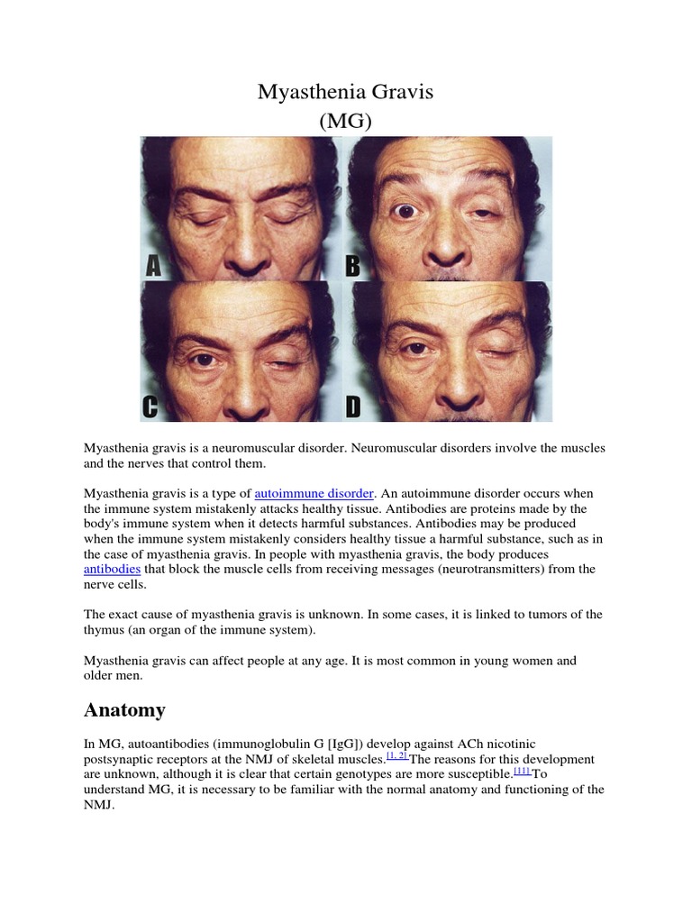 Myasthenia Gravis (MG) : Anatomy | PDF | Neuromuscular Junction | Chemical Synapse