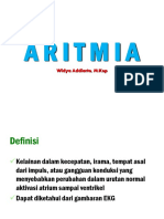 Aritmia